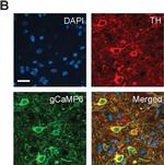 Rabbit IgG (H+L) Cross-Adsorbed Secondary Antibody in Immunohistochemistry (IHC)