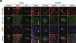 Rabbit IgG (H+L) Highly Cross-Adsorbed Secondary Antibody in Immunocytochemistry (ICC/IF)