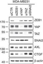 Mouse IgG (H+L) Secondary Antibody in Western Blot (WB)