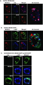 beta Amyloid Antibody in Immunohistochemistry (IHC)