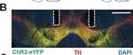 Rabbit IgG (H+L) Cross-Adsorbed Secondary Antibody in Immunohistochemistry (IHC)