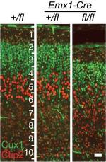 Mouse IgG (H+L) Cross-Adsorbed Secondary Antibody in Immunocytochemistry (ICC/IF)