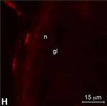 Rabbit IgG (H+L) Highly Cross-Adsorbed Secondary Antibody in Immunocytochemistry (ICC/IF)