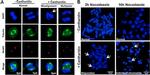 Mouse IgG (H+L) Cross-Adsorbed Secondary Antibody in Immunohistochemistry (IHC)