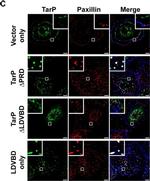 Rabbit IgG (H+L) Highly Cross-Adsorbed Secondary Antibody in Immunocytochemistry (ICC/IF)