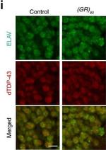 Rat IgG (H+L) Cross-Adsorbed Secondary Antibody in Immunocytochemistry (ICC/IF)