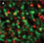 Rabbit IgG (H+L) Cross-Adsorbed Secondary Antibody in Immunocytochemistry (ICC/IF)