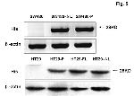 HisG Epitope Tag Antibody in Western Blot (WB)