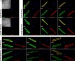 Rabbit IgG (H+L) Cross-Adsorbed Secondary Antibody in Immunocytochemistry (ICC/IF)