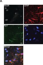 Rabbit IgG (H+L) Highly Cross-Adsorbed Secondary Antibody in Immunohistochemistry (IHC)