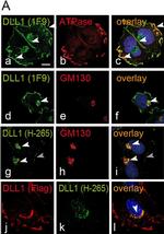 Rat IgG (H+L) Cross-Adsorbed Secondary Antibody in Immunocytochemistry (ICC/IF)