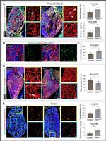 Rabbit IgG (H+L) Highly Cross-Adsorbed Secondary Antibody in Immunohistochemistry (Paraffin) (IHC (P))