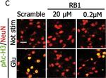 Mouse IgG (H+L) Cross-Adsorbed Secondary Antibody in Immunohistochemistry (IHC)