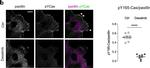 Rabbit IgG (H+L) Cross-Adsorbed Secondary Antibody in Immunocytochemistry (ICC/IF)