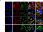 Rabbit IgG (H+L) Highly Cross-Adsorbed Secondary Antibody in Immunocytochemistry (ICC/IF)