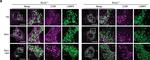 Rat IgG (H+L) Cross-Adsorbed Secondary Antibody in Immunocytochemistry (ICC/IF)