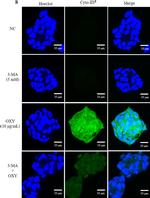 Rabbit IgG (H+L) Cross-Adsorbed Secondary Antibody in Immunocytochemistry (ICC/IF)