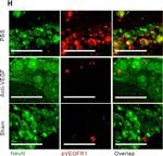 Mouse IgG (H+L) Highly Cross-Adsorbed Secondary Antibody in Immunohistochemistry (Paraffin) (IHC (P))