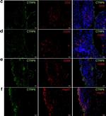 Mouse IgG (H+L) Highly Cross-Adsorbed Secondary Antibody in Immunohistochemistry (IHC)