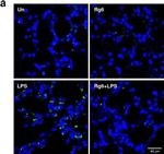 Mouse IgG (H+L) Highly Cross-Adsorbed Secondary Antibody in Immunohistochemistry (Paraffin) (IHC (P))