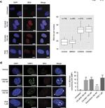 Rat IgG (H+L) Cross-Adsorbed Secondary Antibody in Immunocytochemistry (ICC/IF)