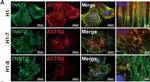 Mouse IgG (H+L) Cross-Adsorbed Secondary Antibody in Immunocytochemistry (ICC/IF)