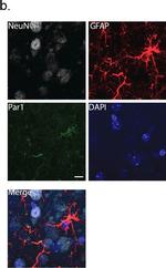 Rabbit IgG (H+L) Highly Cross-Adsorbed Secondary Antibody in Immunohistochemistry (IHC)