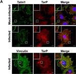 Rabbit IgG (H+L) Highly Cross-Adsorbed Secondary Antibody in Immunocytochemistry (ICC/IF)