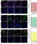 Collagen IV Antibody in Immunohistochemistry (IHC)