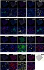 Collagen IV Antibody in Immunohistochemistry (IHC)