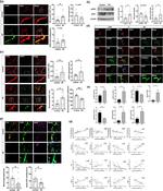 APOE Antibody in Immunohistochemistry, Proximity Ligation Assay (PLA) (IHC, PLA)