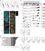 FOXP3 Antibody in Immunohistochemistry (IHC)