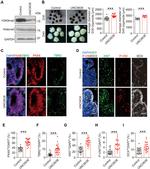 EOMES Antibody in Immunohistochemistry (IHC)