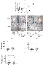 IFN gamma Antibody in Immunohistochemistry (IHC)