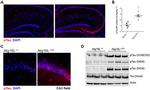 Phospho-Tau (Ser199, Ser202) Antibody in Western Blot, Immunohistochemistry (WB, IHC)