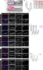 GFAP Antibody in Immunohistochemistry, Immunohistochemistry (Paraffin) (IHC, IHC (P))