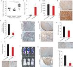 Gata-3 Antibody in Immunohistochemistry (IHC)