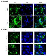 ACE2 Antibody in Immunocytochemistry (ICC/IF)