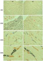 mTOR Antibody in Immunohistochemistry (IHC)