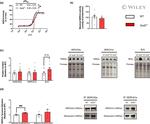 SERCA2 ATPase Antibody in Western Blot (WB)