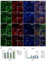 mTOR Antibody in Immunohistochemistry (IHC)