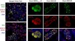 Rabbit IgG (H+L) Cross-Adsorbed Secondary Antibody in Immunocytochemistry (ICC/IF)