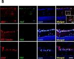 Rabbit IgG (H+L) Cross-Adsorbed Secondary Antibody in Immunohistochemistry (IHC)