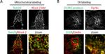 Mouse IgG (H+L) Highly Cross-Adsorbed Secondary Antibody in Immunocytochemistry (ICC/IF)