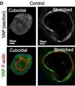 Rabbit IgG (H+L) Cross-Adsorbed Secondary Antibody in Immunohistochemistry (IHC)