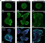 Rabbit IgG (H+L) Cross-Adsorbed Secondary Antibody in Immunohistochemistry (IHC)