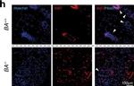 Rabbit IgG (H+L) Cross-Adsorbed Secondary Antibody in Immunohistochemistry (Paraffin) (IHC (P))