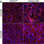 Rabbit IgG (H+L) Cross-Adsorbed Secondary Antibody in Immunohistochemistry (IHC)