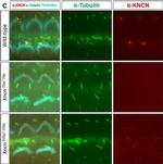 Mouse IgG (H+L) Highly Cross-Adsorbed Secondary Antibody in Immunohistochemistry (IHC)