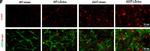 Mouse IgG (H+L) Highly Cross-Adsorbed Secondary Antibody in Immunohistochemistry (IHC)